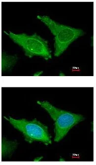 Immunocytochemistry/ Immunofluorescence - Anti-Fibrinogen beta chain antibody (AB137830)