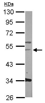 Western blot - Anti-Fibrinogen beta chain antibody (AB137830), expandable thumbnail