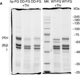 Western blot - Anti-Fibrinogen beta chain antibody (AB137830), expandable thumbnail
