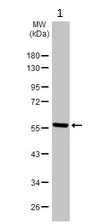 Western blot - Anti-Fibrinogen beta chain antibody (AB137830)