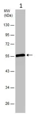 Western blot - Anti-Fibrinogen beta chain antibody (AB137830)