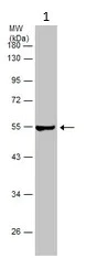 Western blot - Anti-Fibrinogen beta chain antibody (AB137830)