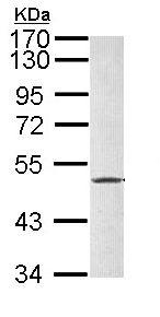 Western blot - Anti-Fibrinogen beta chain antibody (AB137830), expandable thumbnail