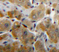 Immunohistochemistry (Formalin/PFA-fixed paraffin-embedded sections) - Anti-Fibrinogen beta chain antibody (AB232793)