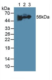 Western blot - Anti-Fibrinogen beta chain antibody (AB232793)
