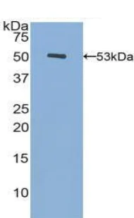 Western blot - Anti-Fibrinogen beta chain antibody (AB232793)