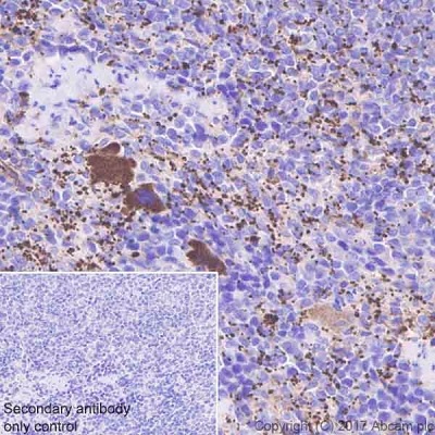 Immunohistochemistry (Formalin/PFA-fixed paraffin-embedded sections) - Anti-Fibrinogen beta chain antibody [EPR18145-84] (ab189490), expandable thumbnail