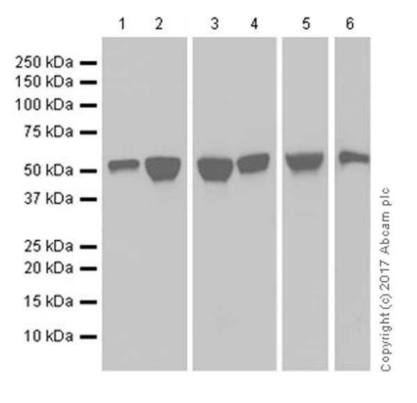 Western blot - Anti-Fibrinogen beta chain antibody [EPR18145-84] (AB189490), expandable thumbnail
