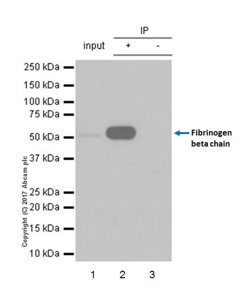 Immunoprecipitation - Anti-Fibrinogen beta chain antibody [EPR19765] - BSA and Azide free (AB251177)