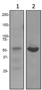 Western blot - Anti-Fibrinogen beta chain antibody [EPR3082] - BSA and Azide free (AB247577)