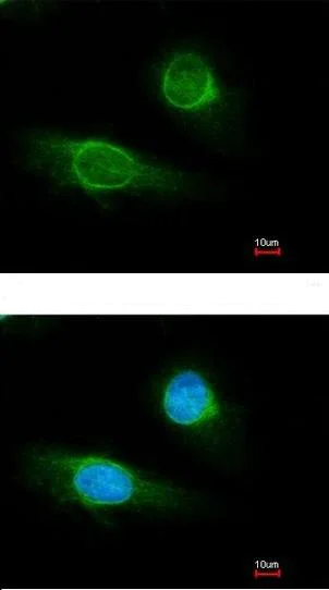 Immunocytochemistry/ Immunofluorescence - Anti-Fibrinogen gamma chain antibody (AB137728)