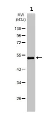 Western blot - Anti-Fibrinogen gamma chain antibody (AB137728)