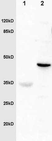 Western blot - Anti-Fibrinogen gamma chain antibody (AB217783)