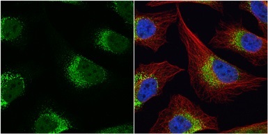 Immunocytochemistry/ Immunofluorescence - Anti-Fibrinogen gamma chain antibody (AB96532)
