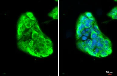 Immunocytochemistry/ Immunofluorescence - Anti-Fibrinogen gamma chain antibody (AB96532)