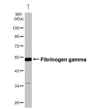 Western blot - Anti-Fibrinogen gamma chain antibody (AB96532)