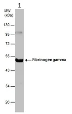 Western blot - Anti-Fibrinogen gamma chain antibody (AB96532)
