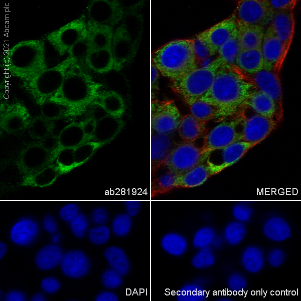 Immunocytochemistry/ Immunofluorescence - Anti-Fibrinogen gamma chain antibody [EP24539-127] (ab281924), expandable thumbnail