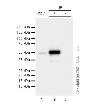 Immunoprecipitation - Anti-Fibrinogen gamma chain antibody [EP24539-127] (ab281924), expandable thumbnail