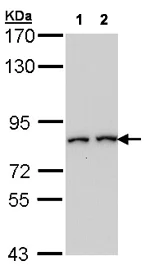 Western blot - Anti-Fibroblast activation protein, alpha antibody (AB137549)