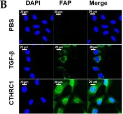 Immunocytochemistry/ Immunofluorescence - Anti-Fibroblast activation protein, alpha antibody (AB53066)