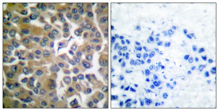Immunohistochemistry (Formalin/PFA-fixed paraffin-embedded sections) - Anti-Fibroblast activation protein, alpha antibody (AB53066)