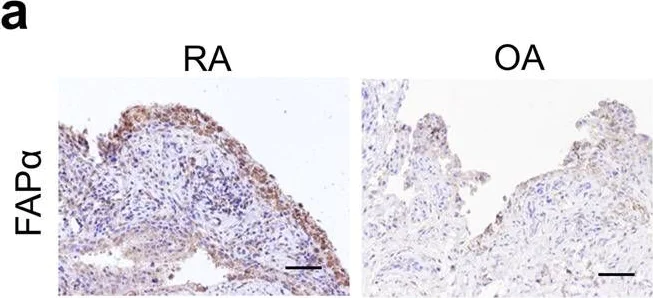Immunohistochemistry (Formalin/PFA-fixed paraffin-embedded sections) - Anti-Fibroblast activation protein, alpha antibody (AB53066)