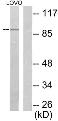 Western blot - Anti-Fibroblast activation protein, alpha antibody (AB53066)