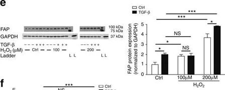 Western blot - Anti-Fibroblast activation protein, alpha antibody (AB53066)