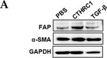 Western blot - Anti-Fibroblast activation protein, alpha antibody (AB53066)