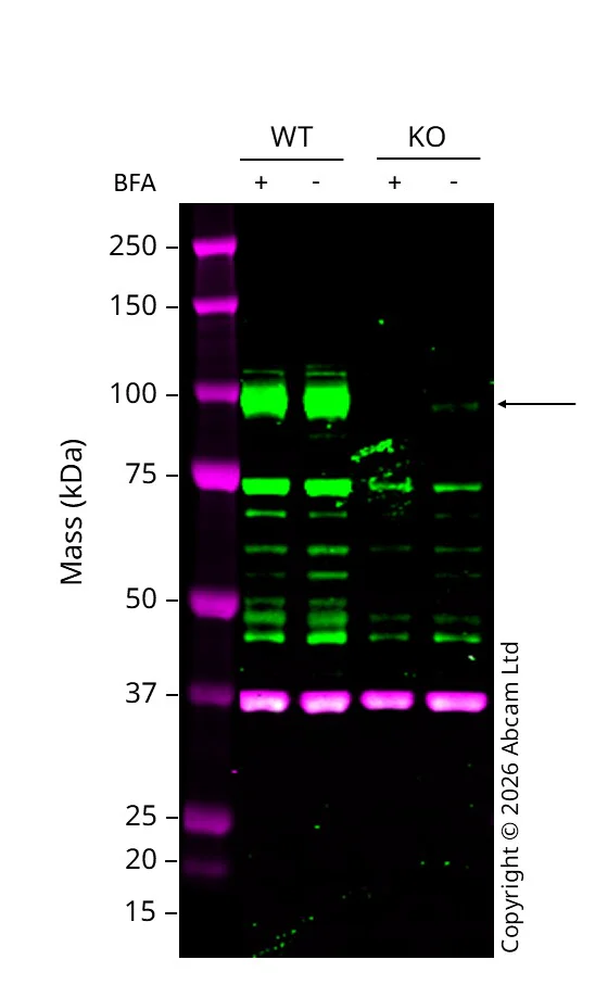 Western blot - Anti-Fibroblast activation protein, alpha antibody [EPR20021] (AB207178)