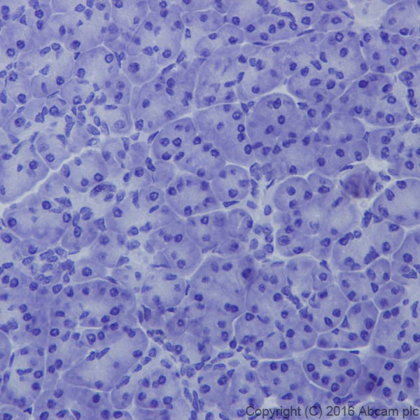 Immunohistochemistry (Formalin/PFA-fixed paraffin-embedded sections) - Anti-Fibroblast activation protein, alpha antibody [EPR20021] - BSA and Azide free (ab271976), expandable thumbnail