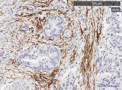 Immunohistochemistry (Formalin/PFA-fixed paraffin-embedded sections) - Anti-Fibroblast activation protein, alpha antibody [EPR20021] - BSA and Azide free (AB271976)