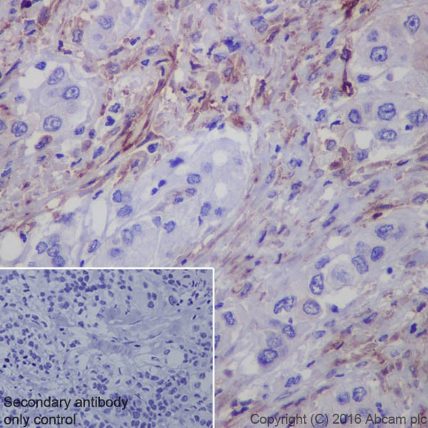 Immunohistochemistry (Formalin/PFA-fixed paraffin-embedded sections) - Anti-Fibroblast activation protein, alpha antibody [EPR20021] - BSA and Azide free (AB271976), expandable thumbnail