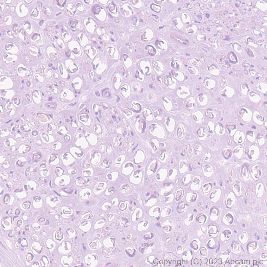 Immunohistochemistry (Formalin/PFA-fixed paraffin-embedded sections) - Anti-Fibroblast activation protein, alpha antibody [EPR20021] - BSA and Azide free (ab271976), expandable thumbnail