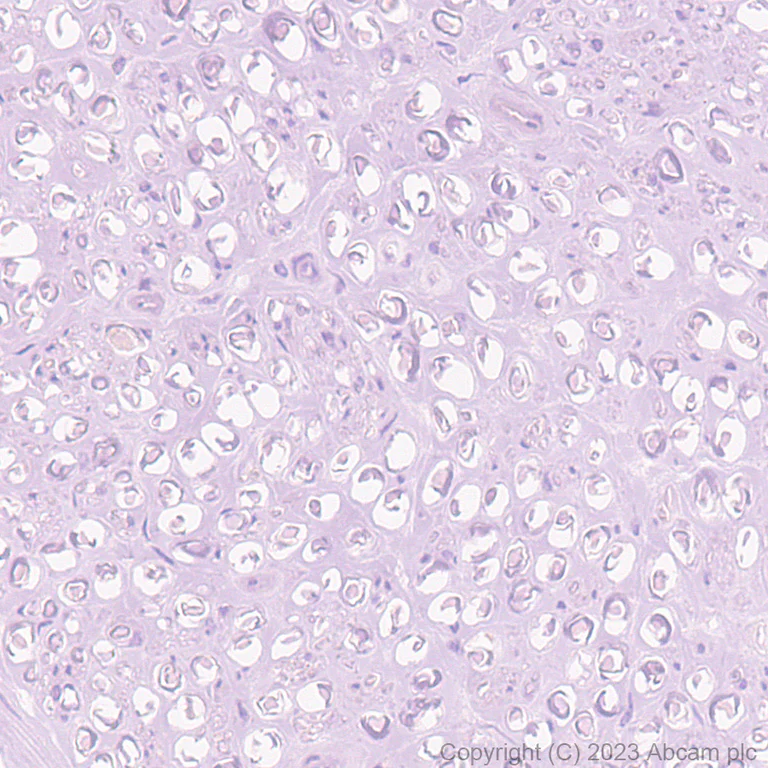 Immunohistochemistry (Formalin/PFA-fixed paraffin-embedded sections) - Anti-Fibroblast activation protein, alpha antibody [EPR20021] - BSA and Azide free (AB271976)