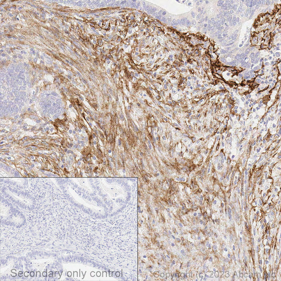 Immunohistochemistry (Formalin/PFA-fixed paraffin-embedded sections) - Anti-Fibroblast activation protein, alpha antibody [EPR20021] - BSA and Azide free (ab271976), expandable thumbnail