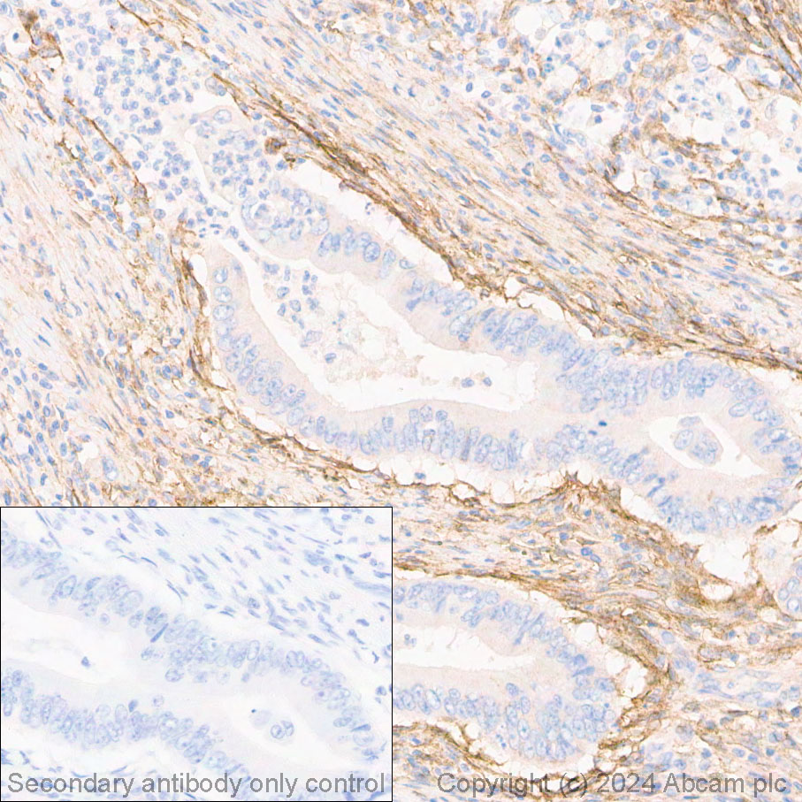 Immunohistochemistry (Formalin/PFA-fixed paraffin-embedded sections) - Anti-Fibroblast activation protein, alpha antibody [EPR20021] - BSA and Azide free (ab271976), expandable thumbnail