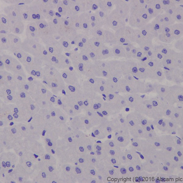 Immunohistochemistry (Formalin/PFA-fixed paraffin-embedded sections) - Anti-Fibroblast activation protein, alpha antibody [EPR20021] - BSA and Azide free (ab271976), expandable thumbnail