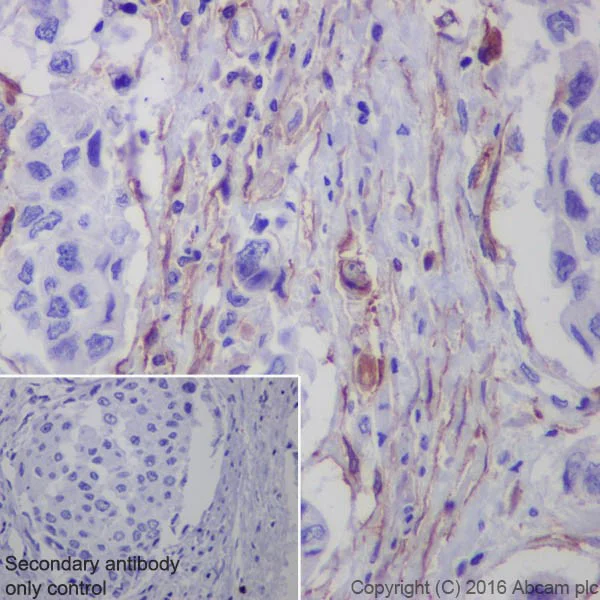 Immunohistochemistry (Formalin/PFA-fixed paraffin-embedded sections) - Anti-Fibroblast activation protein, alpha antibody [EPR20021] - Low endotoxin, Azide free (AB222924)
