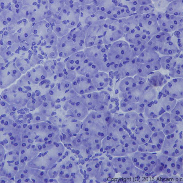 Immunohistochemistry (Formalin/PFA-fixed paraffin-embedded sections) - Anti-Fibroblast activation protein, alpha antibody [EPR20021] - Low endotoxin, Azide free (AB222924)