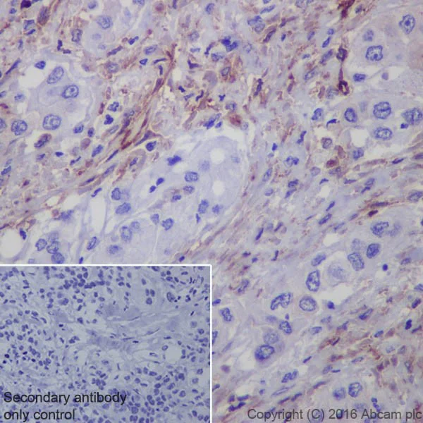Immunohistochemistry (Formalin/PFA-fixed paraffin-embedded sections) - Anti-Fibroblast activation protein, alpha antibody [EPR20021] - Low endotoxin, Azide free (AB222924)