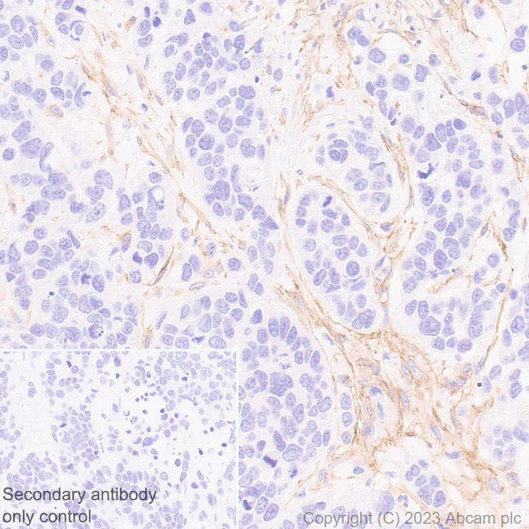Immunohistochemistry (Formalin/PFA-fixed paraffin-embedded sections) - Anti-Fibroblast activation protein, alpha antibody [EPR20021] - Low endotoxin, Azide free (AB222924)