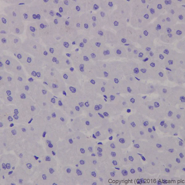 Immunohistochemistry (Formalin/PFA-fixed paraffin-embedded sections) - Anti-Fibroblast activation protein, alpha antibody [EPR20021] - Low endotoxin, Azide free (AB222924)