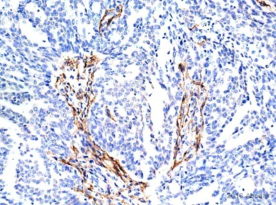 Immunohistochemistry (Formalin/PFA-fixed paraffin-embedded sections) - Anti-Fibroblast activation protein, alpha antibody [EPR20021] - Low endotoxin, Azide free (AB222924)