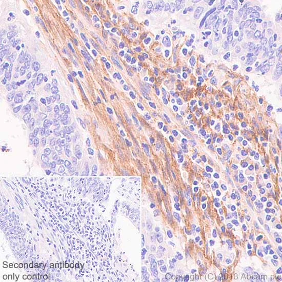 Immunohistochemistry (Formalin/PFA-fixed paraffin-embedded sections) - Anti-Fibroblast activation protein, alpha antibody [SP325] (AB227703)