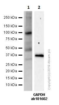 Western blot - Anti-Fibroblast activation protein, alpha antibody [SP325] (AB227703)