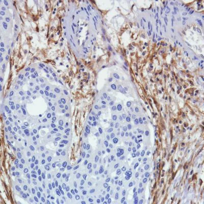 Immunohistochemistry (Formalin/PFA-fixed paraffin-embedded sections) - Anti-Fibroblast activation protein, alpha antibody [SP325] - BSA and Azide free (AB240989)