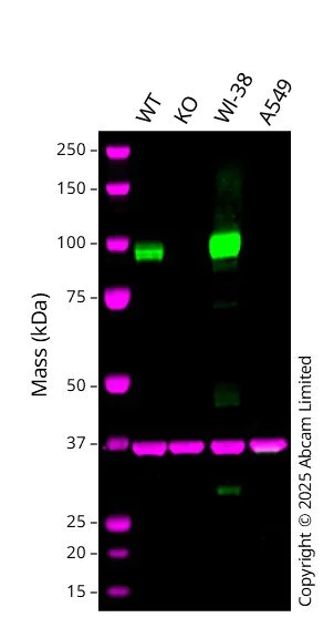 Western blot - Anti-Fibroblast activation protein, alpha antibody [SP325] - BSA and Azide free (AB240989)