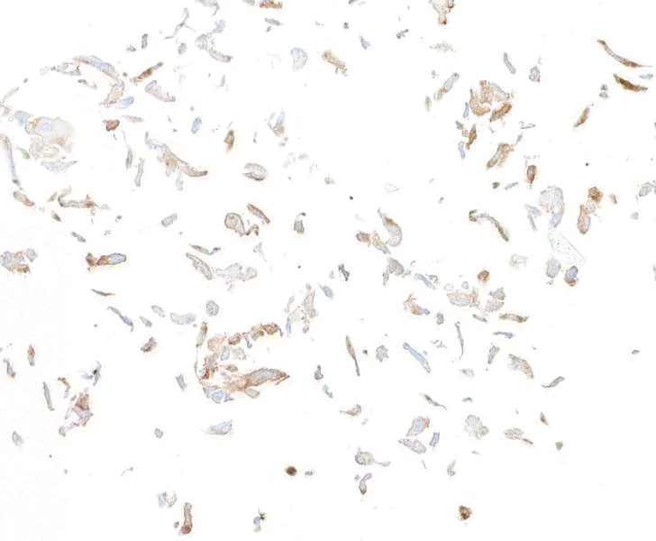 Immunocytochemistry - Anti-Fibroblast Activation Protein alpha/FAP antibody [BLR150J] - BSA free (AB314075)